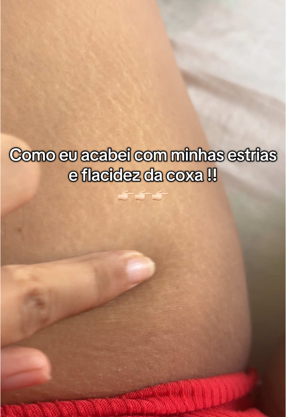 Creme termogenico renovou a minha pele e devolveu minha autoestima .🥹🩷🤌🏻 #cremetermogênico #estrias #flacidez #mulherbrasileira #dicasdebeleza 