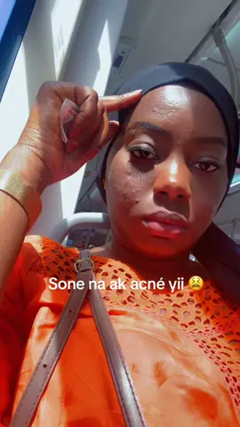 #acneskin #beauty #skincare #fypシ゚ #pourtoi #for #challenge 