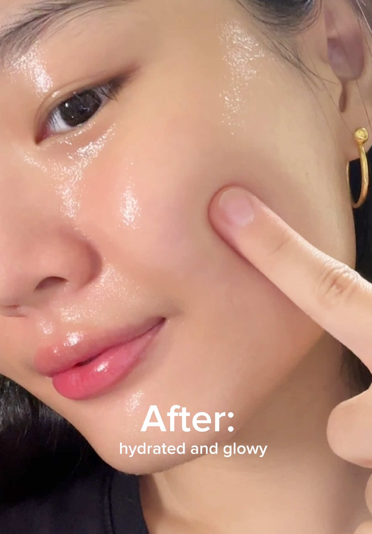 ARENCIA Hyssop Serum 30 💚 Botox on a Budget with @Arencia @Arencia  Product: Arencia - Holy Hyssop Serum 30 #arencia #ricemochicleanser #kbeauty #kskincare #koreanskincare #tiktokmademebuyit #acne #acnecleanser #holyhyssopserum #hyssopserum #overnightmask #acneserum #glassskin