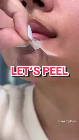 Mighty Patch™️ Chin FTW wondering 👏 #heroemployee #oddlysatisfying #pimplepatches #acne #pimples #fy #fypage 