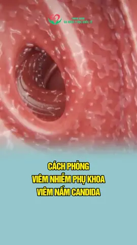 Cách phòng viêm nhiễm chị em cần lưu ý! #xuhuong #phukhoa #namcandida #foryou #fyp #viral #healthcare