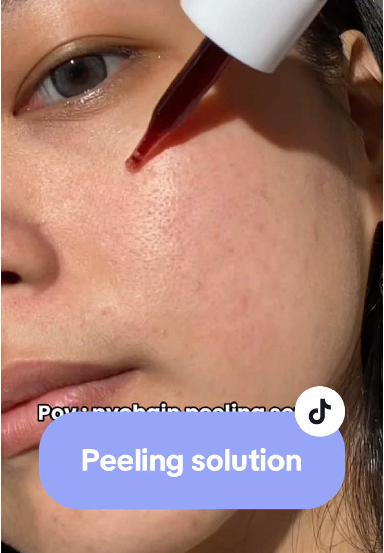Peeling aman buat kulit sensitif #peelingsolution #G2Gpeelingsolution 