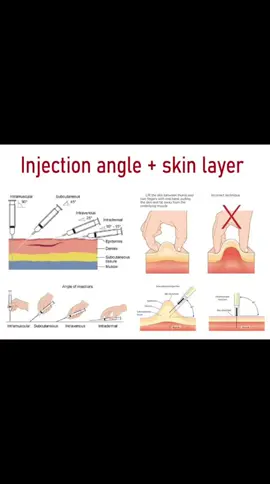 4 cara menyuntik hewan ternak, jangan lupa perhatikan dosis dan peralatan yang steril #wedus #domba #kambing #sapi #lembu #kerbau #kelinci #marmut #pakan #pakanalternatif #pakanternak #ternak #beternak #peternak #peternakmuda #peternakindonesia #peternakmilenial #ngaret #ngarit #sobatngaret #sobatngarit #sobatngaritnusantara #sobatngaretindonesia #sobatngaretsreksrek #sobatngaretnusantara #sobatngaretnusantara🔥🔥🔥 
