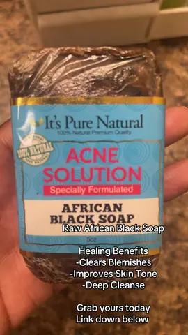 🌿✨ Discover the Healing Power of African Black Soap for Your Skin! ✨🌿 Hey everyone! Today, let’s talk about an amazing skincare gem: African Black Soap! 🌍🛁 Why Use African Black Soap as a Facial Cleanser? Gentle Cleansing 🧼 African Black Soap is great for all skin types! It cleans your face without stripping away natural oils. Say goodbye to dirt and impurities while keeping your skin balanced! Fights Acne 💧 If you’re dealing with breakouts, this soap could be your new best friend! Its natural ingredients help reduce acne and keep your skin clear. Evens Skin Tone 🌈 The rich nutrients in black soap can help fade dark spots and scars, giving you a more even complexion over time. Hydrates and Nourishes 🌼 Don’t worry about dryness! African Black Soap has moisturizing properties that help keep your skin soft and hydrated. Natural Ingredients 🍃 Packed with vitamins A and E, along with antioxidants, it’s a fantastic choice for promoting healthy skin without harmful chemicals. So, if you’re looking for a natural way to boost your skincare routine, give African Black Soap a try! Your skin will thank you! 💖✨ EYE LOVE YOU💚💚💚 The God-Is Of Love🍯💚🌻