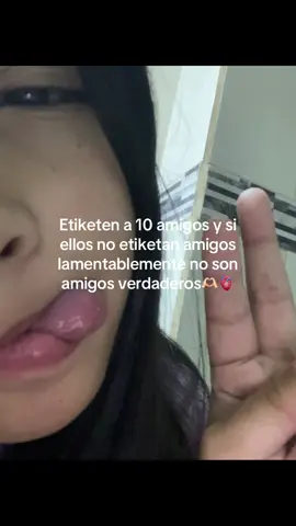 #contendio#amigos#verdaderos#paratiiiiiiiiiiii #qsalgaenparatii #parati💗 #paratiiiiiiiiiiiiiiiiiiiiiiiiiiiiiii #videoparadedicar🌹 #amixtad #parati 