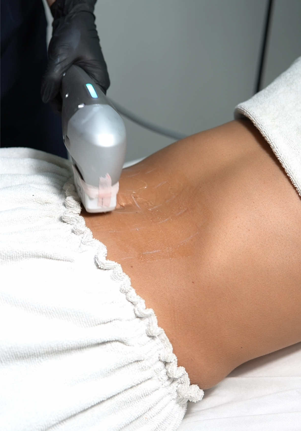 Con el HIFU corporal en Ágada Spa mejora la firmeza de tu piel, define tu figura y luce espectacular✨ . . Encuéntranos en 📍 C. Vista a la Campiña 545-Local 4, Cerro del Tesoro, 45608 #skincare #spa #spagdl #guadalajara #frases  #cuidatupiel #rutinadeskincare