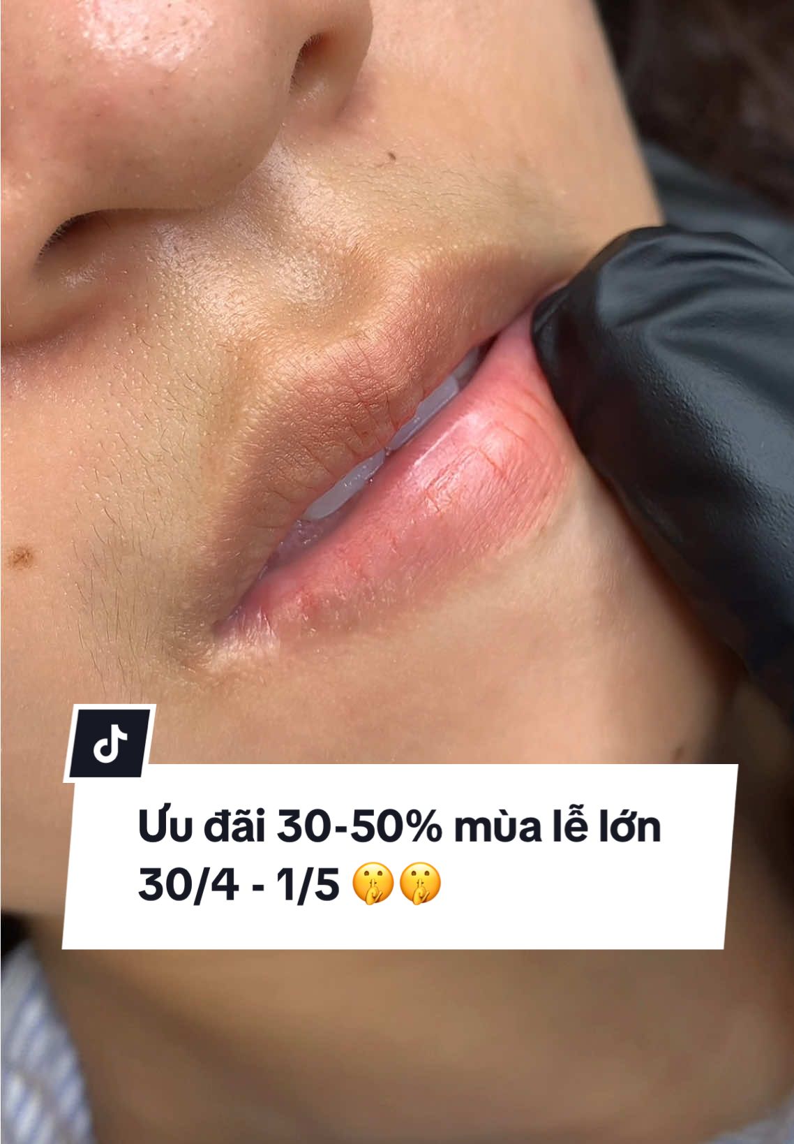 Làm đẹp ăn mừng mùa lễ lớn nhé chị em ơii, bên em đang có nhìu chương trình ưu đãi lắm ạ !! #khuthammoi #phunmoi #phunmoidep #phunmoitunhien #phunmoikithuatchauau #phunmoicollagen #phunxamthammy #phunxamhuyenlee #lamdep #xuhuong 