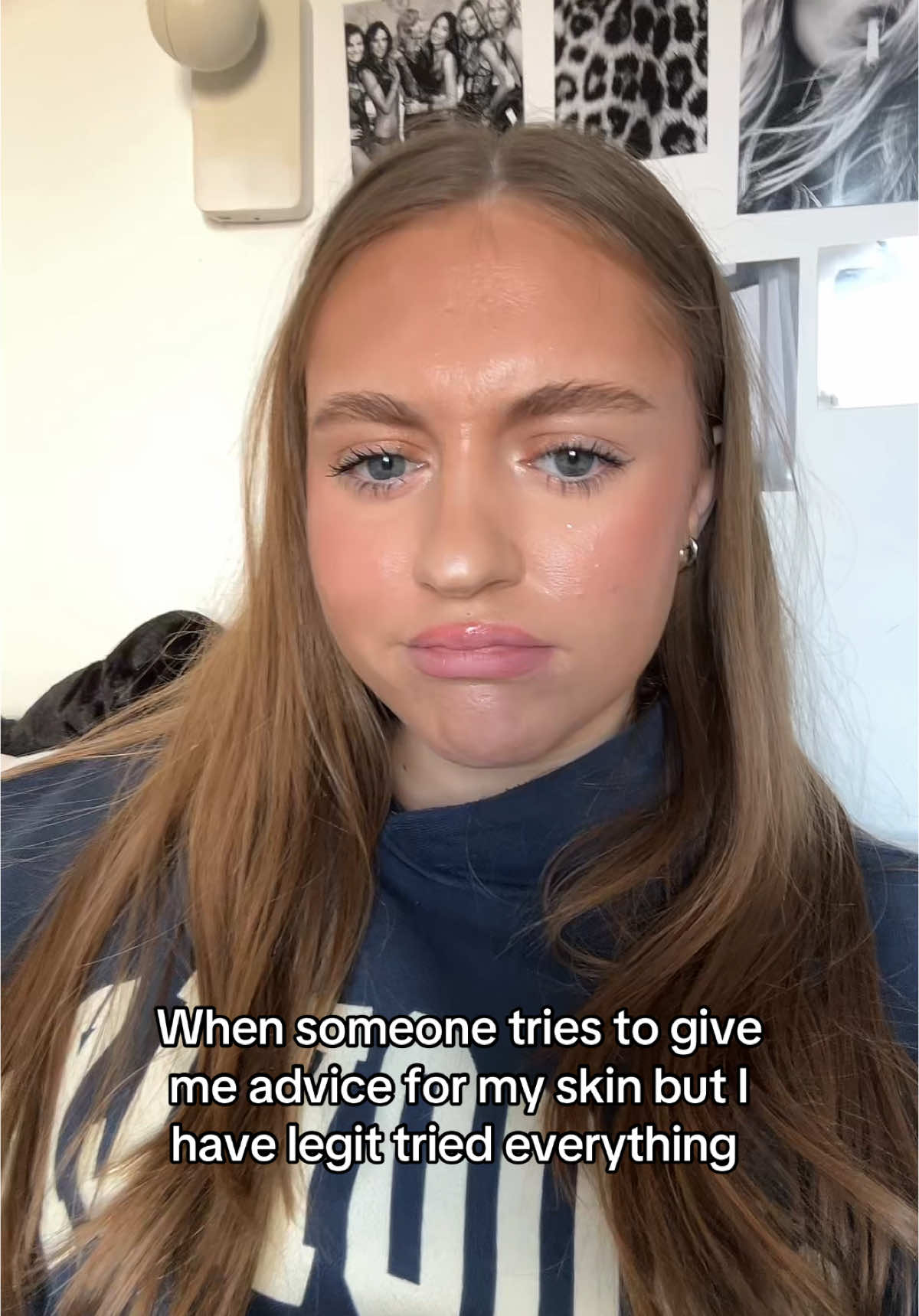I have tired everything #skin #relatable #skincare #acne 