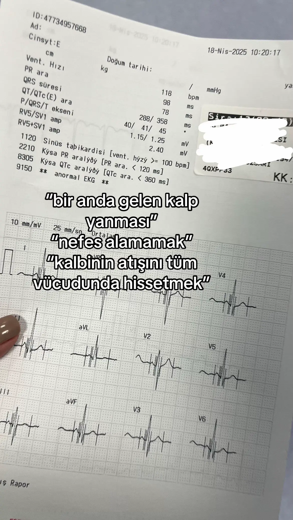 #kalphastalıkları #kalphızı #ekg #çarpıntı #keşfet #wlw #bitiş 