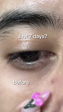 Struggling with fine lines under your eyes? This product might helps. Thank me later! 🫣  #skincare #skintok #kbeauty #koreanskincare #skincareroutine #7days #eyecream #darkcircle #undereyecircles #fyp #foryou 