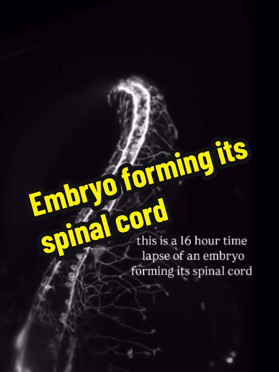 16 hour time lapse of an embryo forming its spinal cord #embryo #embrio #embryos #spinal #cord #forming #timelaps #physics #biology #scienceexperiments #chemistry #education #tiktok #Love #technology #knowledge #Science #biology #education #physics #technology #research #chemistry #space #engineering #nature #art #Astronomy #nasa #stem #scientist #facts #knowledge #medicine #Love #health #universe #sciencefacts #math #memes #learning #neet #study #medical #sciencememes #innovation 