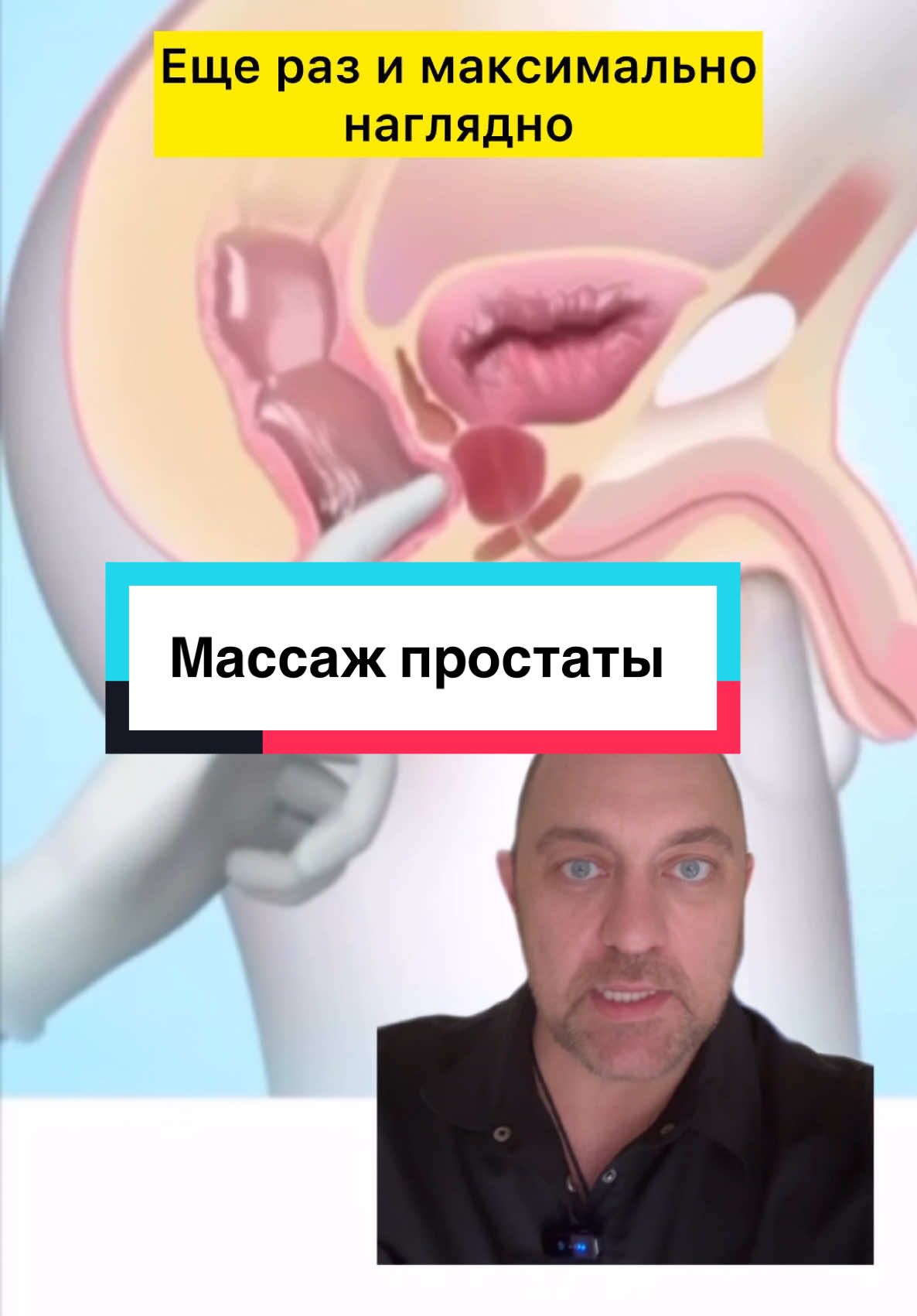 Массаж простаты и лечение простатита 