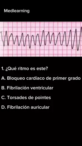 Revisas ECGs puede ser un reto, o una oportunidad para aprender más. Te muestro varios ritmos ¿Puedes reconocerlos todos? Completa el desafío y comenta cuantos identificaste😉 Créditos: @medlearning_online síguelos en Instagram. #estudiantedemedicina #surgery #medicina #enfermeria #paratiiiiiiiiiiiiiiiiiiiiiiiiiiiiiii 