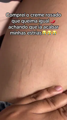 Esse creme rosa tá acabando com minhas estrias brancas 🥹 #creme #estrias #estriasbrancas #lipedema #foryoupage #foliculite #mulher #adeus #cremerosa #brasil 