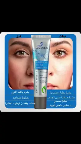 ✅ Inno Gialuron - المنتج الروسي الاصلي مصل فعال لمكافحة الشيخوخة تجديد البشرة فوائد : الترطيب 💧 + توفير التغذية 🍊 + ترميم البشرة وحمايتها 🛡️ 🔸 كريم رئيسي في إزالة التجاعيد ونضاره البشره * تأثيرات المنتج التالية: ✅ يساعد على ترطيب البشرة. ✅ يساعد على تغذية البشرة. بفضل الفيتامينات والمغذيات الدقيقة التي يوفرها **Inno Gialuron** ، ينتج الجلد الكولاجين والإيلاستين 💪 ✅ يساعد على تنشيط البشرة. يساعد الإيلاستين والكولاجين الموجودان في **Inno Gialuron** على تنعيم التجاعيد وإحياء الطبقة الواقية على سطح الجلد . 💸سعر العلبة: 59 💸 سعر العلبتين: 118+علبه هديه 🚚 توصيل لجميع المحافظات: مجاني 📱 الاتصال على الرقم: **07838452264** (واتساب) #iraq🇮🇶 #cream #russicrem #innogialuronaluron #innogialuroniraq