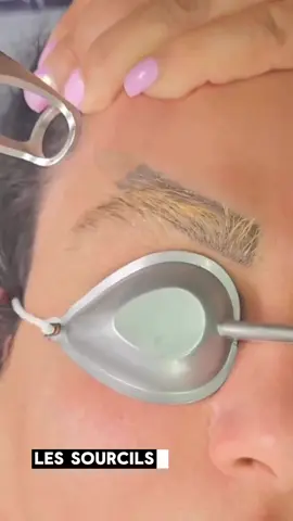 ✨ Nouvelle prestation chez LYA Paris : le DÉTATOUAGE DE SOURCILS ! ✨ Vous en avez assez de votre ancien microblading qui a mal tourné ou dont la couleur ne vous plaît plus ? Avec notre technique douce et efficace, retrouvez vos sourcils naturels et un regard frais en quelques séances. Repartir sur une toile vierge n’a jamais été aussi simple !  💥 Offre de lancement : 1ᵉʳ séance de détatouage à seulement 50€ ! 💥 📲 Réservez votre séance dès maintenant chez @LYAPARIS_ #detatouage #detatouagesourcils #sourcils #microblading #microbladingremoval #microbladingcorrection #regard #regardintense #brows #browartist #browstudio #soinsvisage #soinssourcils #beauty #beaute #parisbeauty #lyaparis #lyaparis_ #nouveaute #soinspersonnalises #esthetique #esthetician #beautyaddict #confidenceboost #GlowUp #SelfCare #nouveauservice #Paris1er #Paris2e #Paris3e #Paris4e #Paris5e #Paris6e #Paris7e #Paris8e #Paris9e #Paris10e #Paris11e #Paris12e #Paris13e #Paris14e #Paris15e #Paris16e #Paris17e #Paris18e #Paris19e #Paris20e #Melun #Fontainebleau #Meaux #Provins #Torcy #Versailles #Rambouillet #MantesLaJolie #SaintGermainEnLaye #Evry #Etampes #Palaiseau #Nanterre #BoulogneBillancourt #Antony #Bobigny #LeRaincy #SaintDenis #Creteil #LHayLesRoses #NogentSurMarne #Pontoise #Sarcelles #Argenteuil 