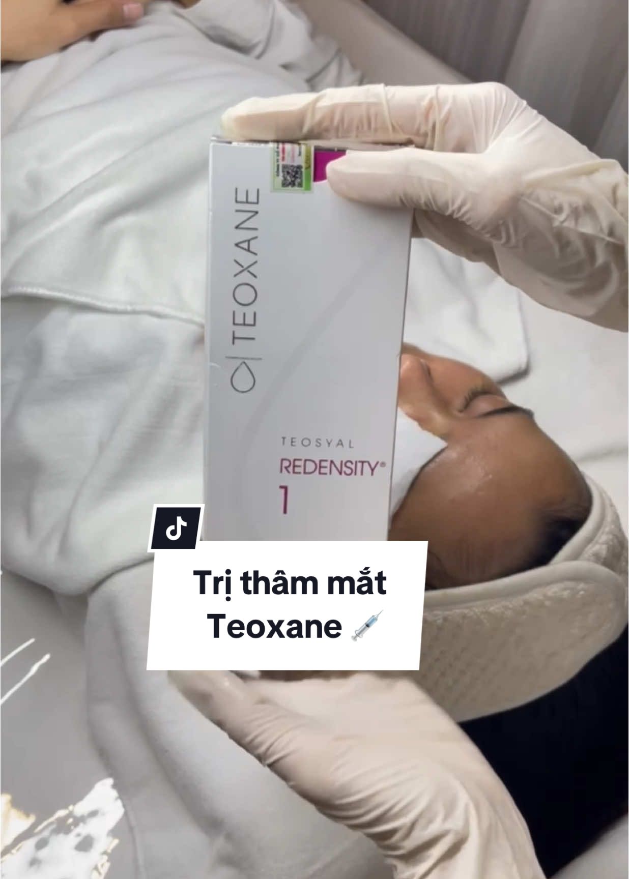 Teoxane Redensity 1 • Được thiết kế đặc biệt với độ mềm – nhẹ – đàn hồi cao, phù hợp vùng da mỏng quanh mắt • Kết hợp HA + 8 loại amino acid, antioxidant và vitamin – không chỉ làm đầy mà còn nuôi dưỡng mô da quanh mắt • Hiệu quả giảm thâm – sáng vùng quầng mắt – đầy rãnh lệ (tear trough) • Không vón – không bầm – không “lộ filler” #spadanangchuyendieutri #mesotherapy #mesomat #trithammat #trithammatteoxane 