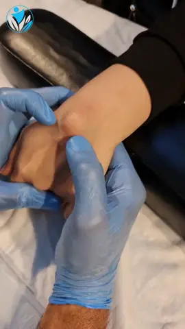 علاج يدوي دقيق… ونتيجة مباشرة بدون جراحة! الكيس الزلالي في مفصل اليد يسبب ضغط مزمن على الأربطة والأوتار. في هذا الفيديو نستخدم تقنية خاصة لتحرير المفصل وتخفيف التورم بطريقة آمنة. This manual pressure technique helps release the ganglion cyst fluid without surgery, improving joint mobility and reducing pain. للحجز أو الاستفسار واتساب: 07812317873 هذا العلاج مبني على خبرة تراكمية، مو مجرد حركات يد… بل علم وتخصص ونتائج تُثبت نفسها. It’s not just pressure — it’s precise, professional, and proven. تابع باقي الحالات والعلاجات اليدوية المتقدمة على صفحتنا في تيك توك لمزيد من الفائدة. Check out the rest of our videos on TikTok for more real cases and expert techniques. #علاج_يدوي #كيس_زلالي #Manual_Therapy #علاج_الأربطة #Ganglion_Cyst #مفصل_اليد #علاج_بلا_جراحة #علاج_العصب #Physical_Therapy #Baghdad_Physio 