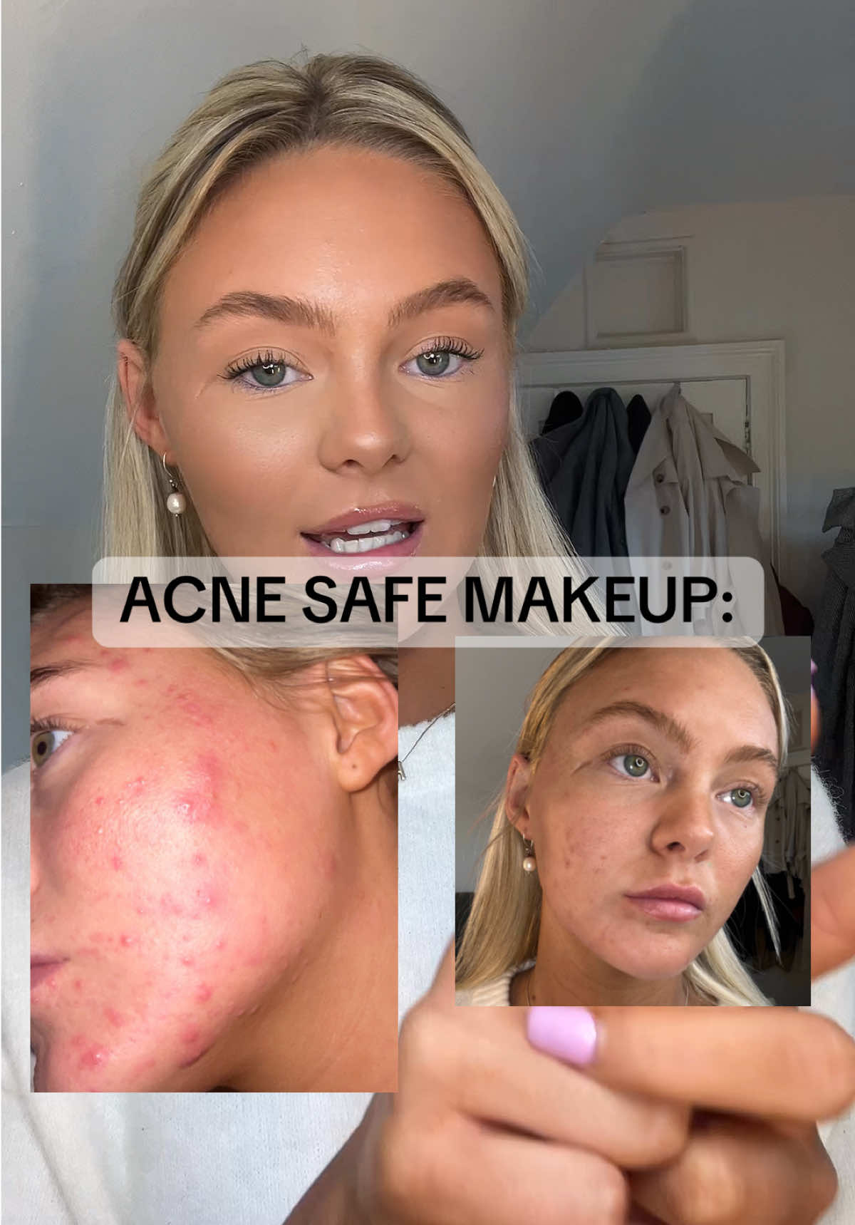 Acne safe makeup products!!!!🥳 over the last 3 weeks I have been using just acne safe products and my skin has improved soooo much!  All of these products have been checked using different acne safe checker websites 🫶🏼 @YSL Beauty skin tint @Yepoda dewy day cushion foundation  @Diorbeauty skin correct concealer  @NARS Cosmetics radiant concealer  @Charlotte Tilbury cream bronzer & setting spray  @Saie dew cream blush #acne #acnesafemakeup #makeup #acnesafeproduct 