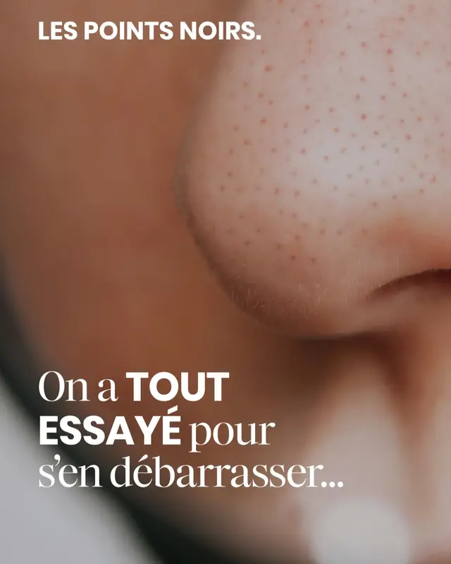[FR] On est tous passés par là : lutter contre les points noirs comme un combat sans fin. La bonne nouvelle ? Plus besoin de traitements agressifs et fini la peau irritée. Le Gel-en-Cellulose HYALURX exfolie en douceur, désincruste les pores et élimine les points noirs tout en préservant l’équilibre de la peau, grâce à sa texture innovante gélifiée qui se transforme en cellulose gommante. Notre conviction : allier sensorialité, efficacité et tolérance.😊 [EN] We’ve all been there—fighting blackheads like a never-ending battle. The good news? No more harsh treatments, no more irritated skin. HYALURX Gel-to-Cellulose gently exfoliates, unclogs pores, and removes blackheads while preserving the skin’s balance, thanks to its innovative gel texture that transforms into buffing cellulose. Our belief: skincare should combine sensoriality, efficacy, and tolerance. 😊 #rexaline #hyalurx #BounceBack #HYALURXSOLUTIONS