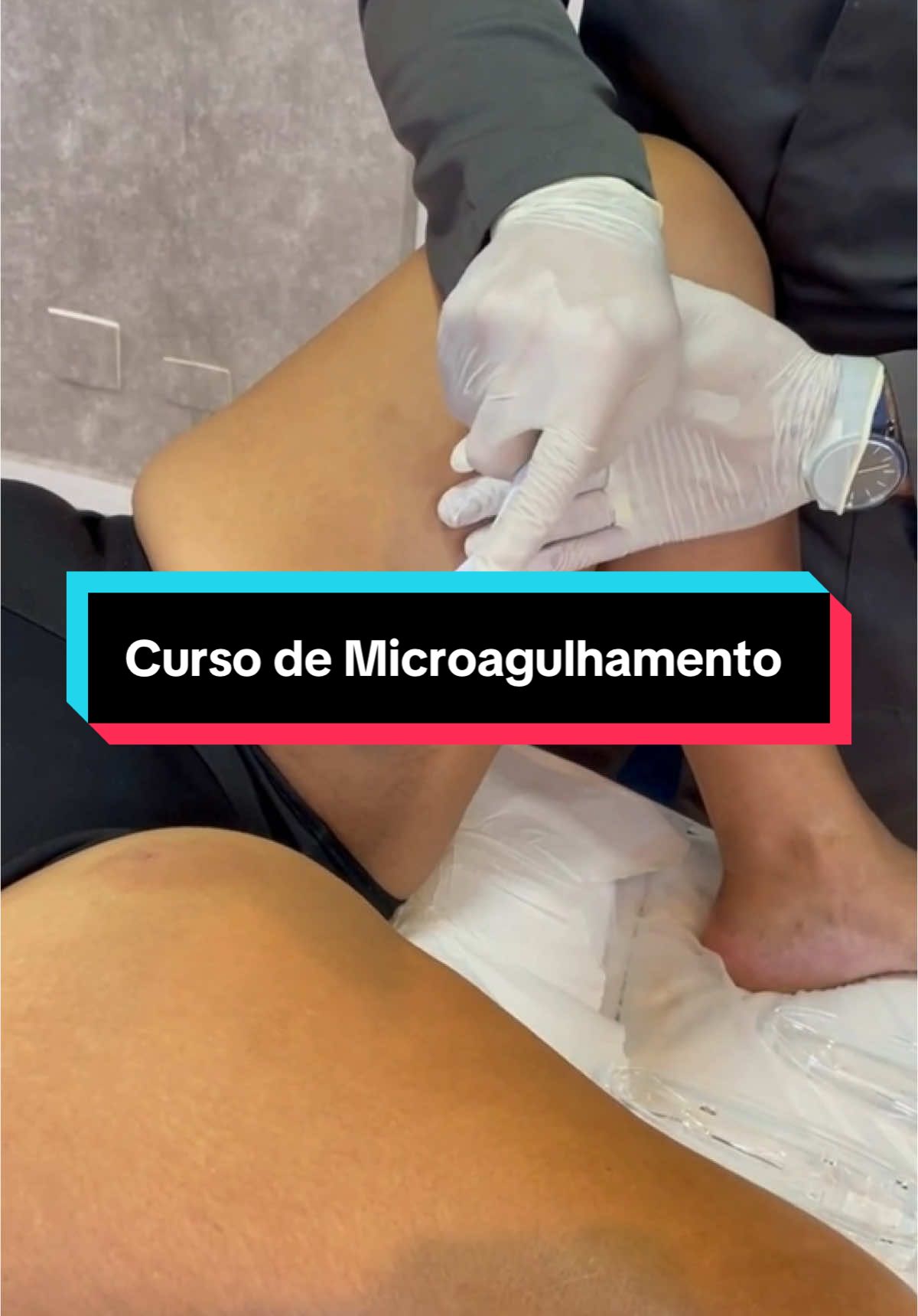 Quer aprender como dominar o Microagulhamento para entregar os melhores resultados, fidelizar os seus clientes e faturar mais? Comente “EU QUERO”👇