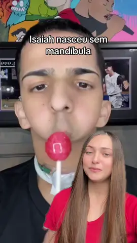 Isaiah nasceu sem mandíbula #dentista #mandibula #dentes #odontologia #greenscreen 