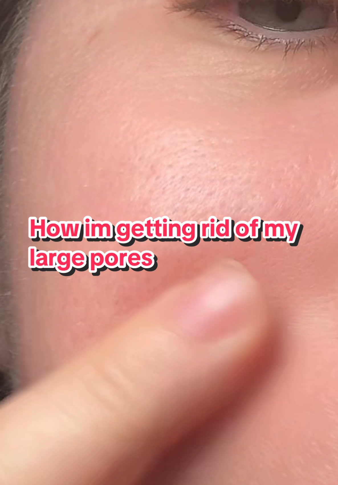 How I’m getting rid of my huge pores @medicube #doublecleansing #largepores #minimizepores #cleanser #blackheads #acne #pimples 