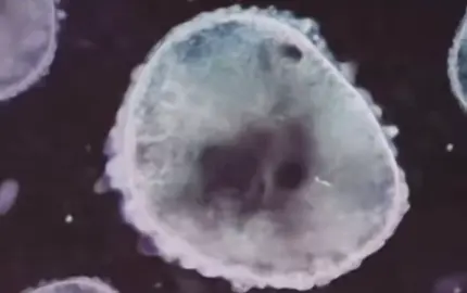 #addictionrecovery #addict #fy #fypage #fyyyyyyyyyyyyyyyyyyy #viralvideo #viral #edit #edits #Love #movies #like #addictionisreal #addict #addictionawareness #meds #awareness #tw #follow #followme 