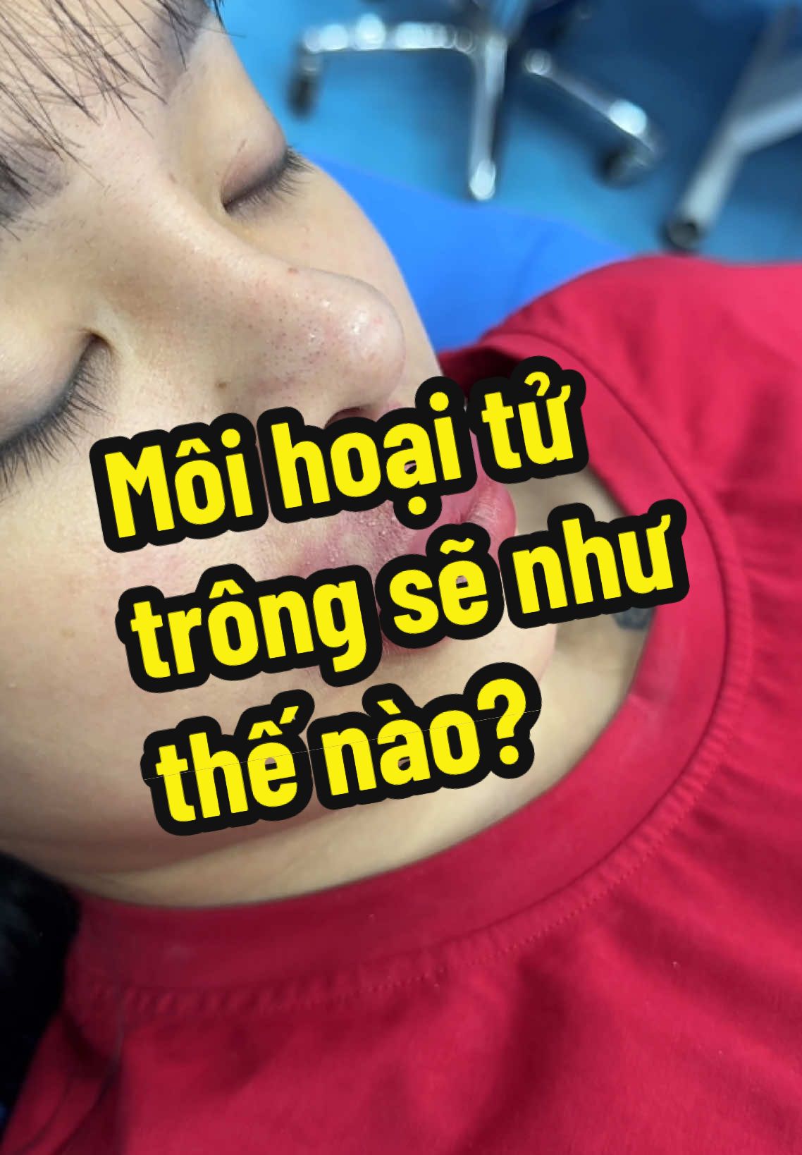 Môi hoạ i t ử trông sẽ như thế nào #trangpham365 #kienthucfillerbotox #tiemfillerchatluonggiare #kinhnghiemthammy #fillerbotoxuytin #canchinhfullface #canchinhkhuonmat #tmvchaewon #chaewonbeauty #daotaofillerbotoxuytin 