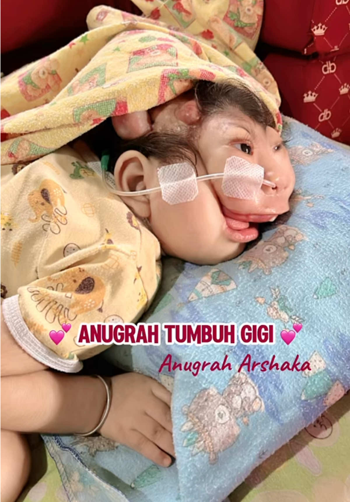 Anugrah tumbuh gigi 💕 #anugraharshaka #anilestariofficial #bayitiktok #fyppppppppppppppppppppppp 