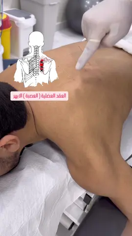 دكتور وائل - قطر 🇶🇦 عيادة الاقصى الطبية  44353944 - 50186516 #qatar🇶🇦 #قطر 