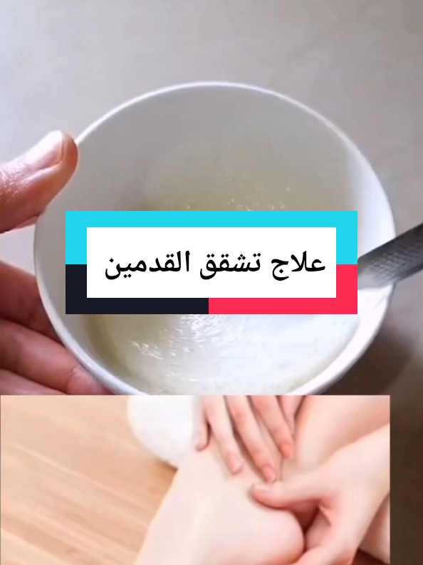 #علاج تشقق القدمين #forypupage #zoommyface #الشعب_الصيني_ماله_حل😂😂 