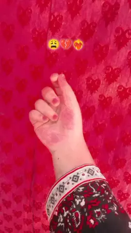 #😩❤️‍🔥💔 