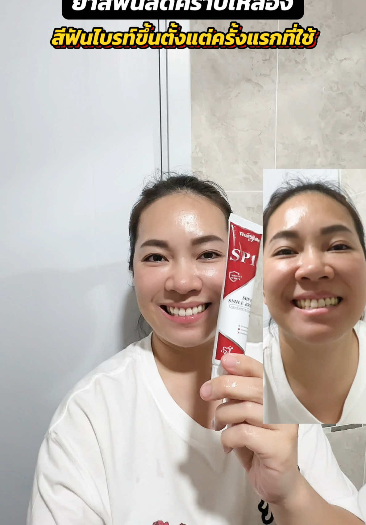 ยาสีฟันลดคราบเหลือง ฟันไบรท์ขึ้นตั้งแต่ครั้งแรกที่ใช้ หลอดนึงใช้ได้นานเป็นเดือนใครฟันเหลืองจัดเลย #ยาสีฟัน #ยาสีฟันลดคราบเหลือง #ยาสีฟันsp10 #ของใช้ในบ้าน #ของดีบอกต่อ