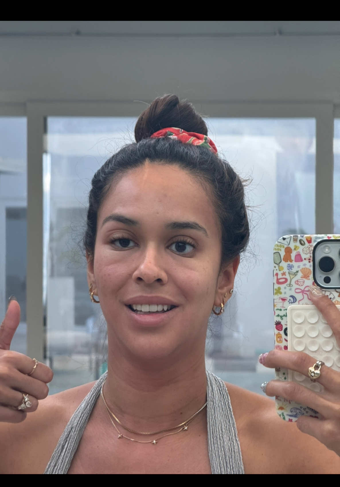 The A in Aruba is for allergic reaction ❤️👹 