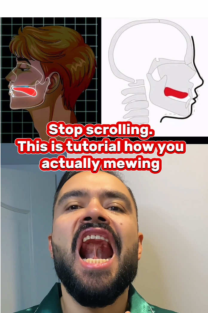 Part 4 - Mewing the right way — 4 key exercises to boost jawline, posture, and facial symmetry. Do them daily. Stay consistent. See the difference. #mewing #mewingtutorial #jawexercises #facialfitness #creatorsearchinsights #glowupformen #jawline #faceworkout #malebeauty #facialsymmetry #masculineenergy #luxmaxing #healthtips #SelfCare #chiseledjawline #faceaesthetics #jawtraining #bonebased #mewingresults #mewingdaily #dailyglowup #alphaappeal #posturecheck #highvalueaesthetic #menscare #lookmaxxing #gentlemenguide #faceglowup #sharpenyourface #mewingchallenge #facetraining #SelfImprovement  @GenPrimeX 