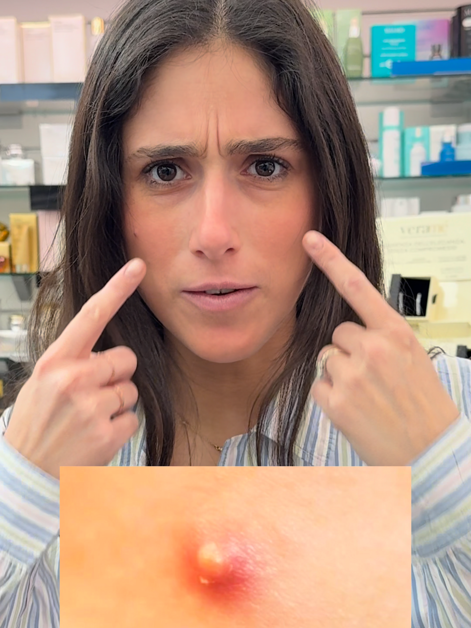 👉🏻 Sappiamo che è difficile ma non devi schiacciarlo! Tu hai mai resistito alla tentazione di schiacciare un brufolo?  #farmacia #milano #farmaciaboccaccio #skincare #brufoli #rimedibrufoli