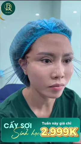 Bạn đang lo lắng vì da bắt đầu chùng, nhăn và xuất hiện rãnh cười? Công nghệ CẤY SỢI SINH HỌC chính là giải pháp trẻ hóa KHÔNG PHẪU THUẬT – được các chuyên gia da liễu tin chọn. 💎 Ưu đãi cực sốc: 👉 Giá gốc 10 triệu – Giảm chỉ còn 2.999.000đ Hiệu quả vượt mong đợi: ✅ Da săn chắc, cải thiện rãnh cười rõ rệt ✅ Duy trì độ đàn hồi lên tới 5 năm ✅ Không đau – không nghỉ dưỡng – an toàn tuyệt đối 📍 Chỉ mất 60 phút thực hiện cùng bác sĩ chuyên khoa 📑 Có bảo hành & cam kết bằng văn bản minh bạch 🎁 Tặng liệu trình tái tạo da FaceWhite trị giá 1.800.000đ 🎁 1 năm chăm sóc, detox phục hồi da & trẻ hóa da tay miễn phí 🚗 Hỗ trợ xe đưa đón tận nơi 👉 Inbox để được bác sĩ thăm khám miễn phí 🔗 Fanpage: Dr Quân - Phòng khám thẩm mỹ