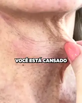 LINK NO MEU PERFIL!! #RugasNuncaMais #AdeusLinhasDeExpressão #PeleJovem #SkincareAntiRugas #BelezaNatural #CuidadosComAPele #EstéticaFacial #Rejuvenescimento #ColágenoNatural #TratamentoFacial #PeleSemRugas #AutoCuidado #HidrataçãoDaPele #PeleFirme #PeleRadiante #DicasDeBeleza #PeleDePorcelana #PeleGlow #PeleRenovada #PeleImpecável​ #AntiRugasCaseiro #ZeroLinhas #SegredoDaPeleLisa #RugasNuncaMasBeleza #RugasZero #SemBotox #SegredoOrientalPele #BelezaSemFiltro #DesafioRugas #ReceitaAntiRugas #TruqueAntiIdade #PeleSemIdade #RotinaAntiRugas #PeleRejuvenescida #JuventudeNaPele #TruqueDaJuventude #RejuvenescerNaturalmente #SegredoDaPelePerfeita #TratamentoNaturalRugas