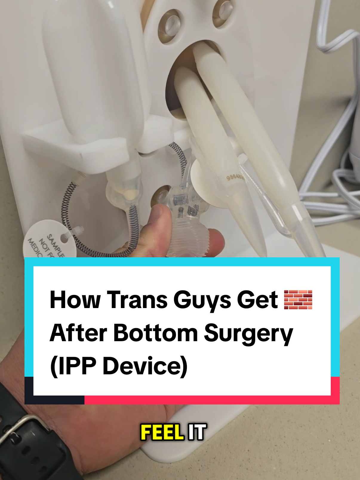 Why is she whispering 💀😂 Best part, we stay 🆙️ as long as we please #ftm #transman #trangender #implant #lgbt #lgbtq #bottomsurgery #phalloplasty #transition #genderaffirmingcare #genderaffirmingsurgery #prosthesis #menshealth #transguy 