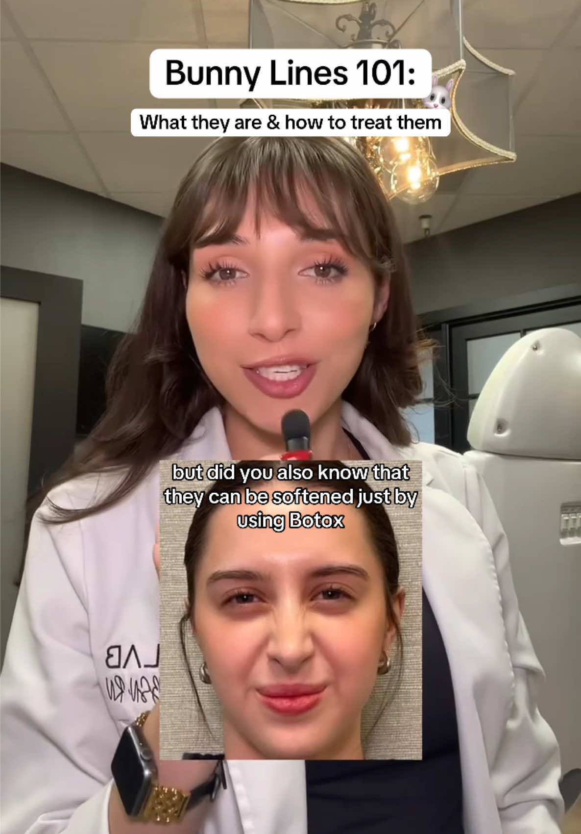 Notice little lines on your nose when you smile or scrunch? Those are bunny lines — and Botox can help smooth them out 🐰 This April: get FREE bunny line tox with the purchase of 10 units 🌼 @Kennedy | Aesthetic Injector  #Botox #Filler #MedSpa #FacialBalancing 