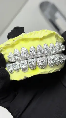 Hot style  Top 10 & bottom 10 #Grillz #jewelry #icedout #vvsdiamonds 