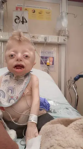 VISITANDO EL HOSPITAL DE MADRUGADA !!!! 😵😣 #Enzo #luchaconstante #siempreconmusica #paratiiiiiii #paratiiiiiiiiiii🙌🏻 