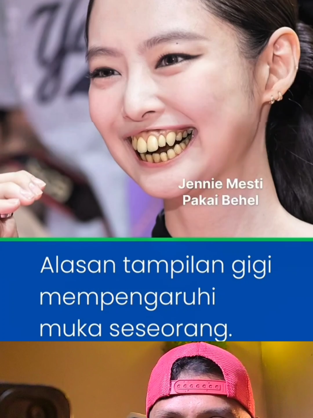 makanya rajin sikat gigi... #reaction #halu#gigi