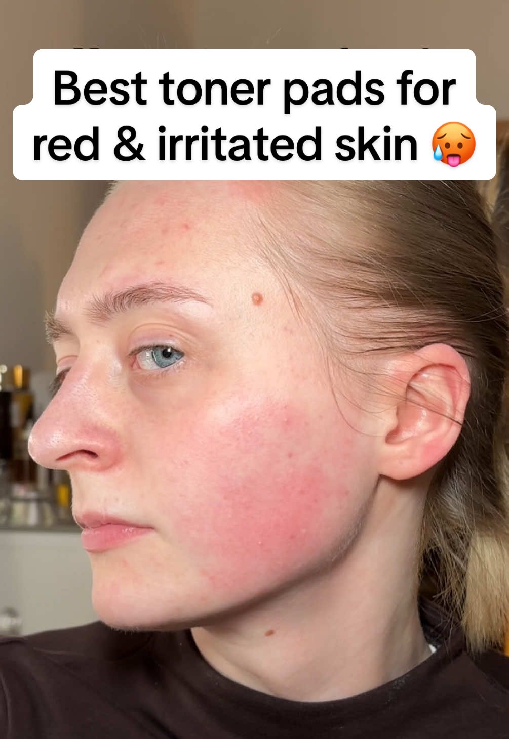 Carrots for cool skin ✊🏼🥕💧 Okay, you guys NEED to know about my secret weapon for irritated and red skin! 🔥 Introducing the SKINFOOD Carrot Carotene Calming Water Pads! These have been an absolute lifesaver, especially after a bit too much sun or when my skin is feeling sensitive after trying new products. 😌 The immediate cooling sensation is just heavenly! ☁️ They instantly calm any redness and make my skin feel soothed and refreshed. What I love about these is how versatile they are! You can use them as a quick toner pad all over your face, or leave them on specific areas like a mini mask for extra calming power! 🧖‍♀️ And get this – you get 60 pads in the tub, but each pad is super stretchy and doesn't rip easily, so you can actually split them in half! That means you're getting a whopping 120 pads in total! 🤯 Talk about value for money! They have a subtle, lovely carrot scent and are packed with carrot seed oil and carrot root extract, which are rich in beta-carotene. This helps to seriously soothe sensitive skin and restore that precious skin barrier! 💪🏼 And the best part? They're super affordable! Right now, you can snag them for only 15€ on YesStyle! 💸 Seriously, if your skin gets easily irritated or red, you NEED these in your life! 🙌🏼 Use my code “YESLISA21” to save extra when ordering these on YesStyle 🤑💸💰 #skinfood #carrotcarotene #calmingwaterpad #tonerpad #kbeauty #koreanskincare #skincare #irritatedskin #rednessrelief #soothingskincare #carrotskincare #betacarotene #skinbarrier #sensitiveskin #maskpad #affordablekbeauty #yesstyle #yesstylecode #skincarelover #skincareaddict #calming #hydrating #koreanbeauty #skincareroutine @skinfood_global @skinfood_official @YesStyle 