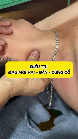 BẤM NGUYỆT ĐIỀU T.R.Ị Đ.A.U MỎI VAI GÁY CỨNG CỔ #xuongkhop #thoatvidiadem #covaigay #daucovaigay #xuhuong 