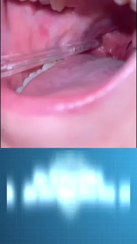 Bấm ngay vào phiên live để có mức giá ưu đãi chỉ trong hôm nay #QuàTặngÝNghĩa #ChămSócRăngMiệng #NụCườiTỏaSáng #SứcKhỏeRăngMiệng #SạchMảngBám #RăngSángKhỏe #DùngLàThích #TrảiNghiệm2Ngày #FlossieUltra #RăngTrắngSáng #FlashSale #MãGiảmGiá #GiftIdeas #DealSốc #nhacchaymoingay