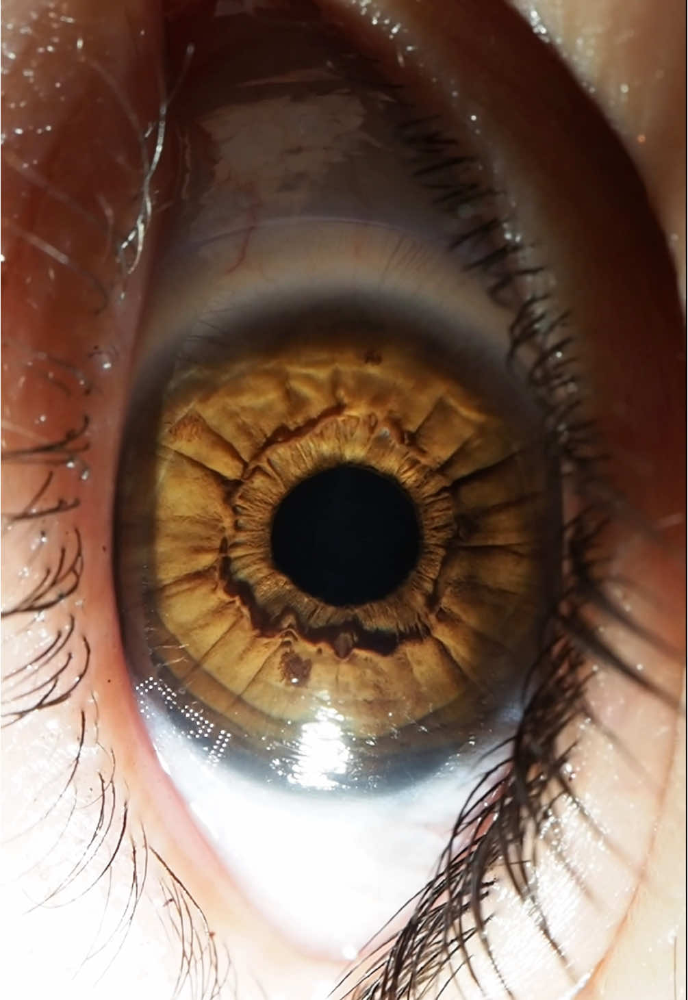 Beautiful eye, how Iris getting constricted😍😍😍🥰 #iris #iris_photography #eyes #photography 