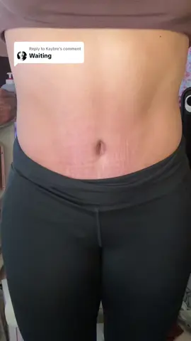 Replying to @Kaybre almost 8 weeks post op! 🥳🥳🥳🥳 #tummytuckjourney #tummytuckrecovery #results #postop #belly #bellybutton #looseskin #lipo #abdominoplastia #surgerytiktok 
