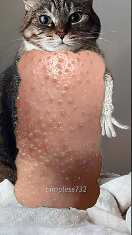 #pimple #pimplepopping #foryourpage #zithappens #squeezeyuk #zitpop 